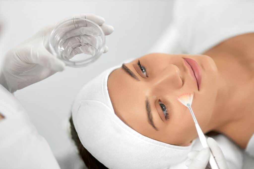 o que é peeling de fenol