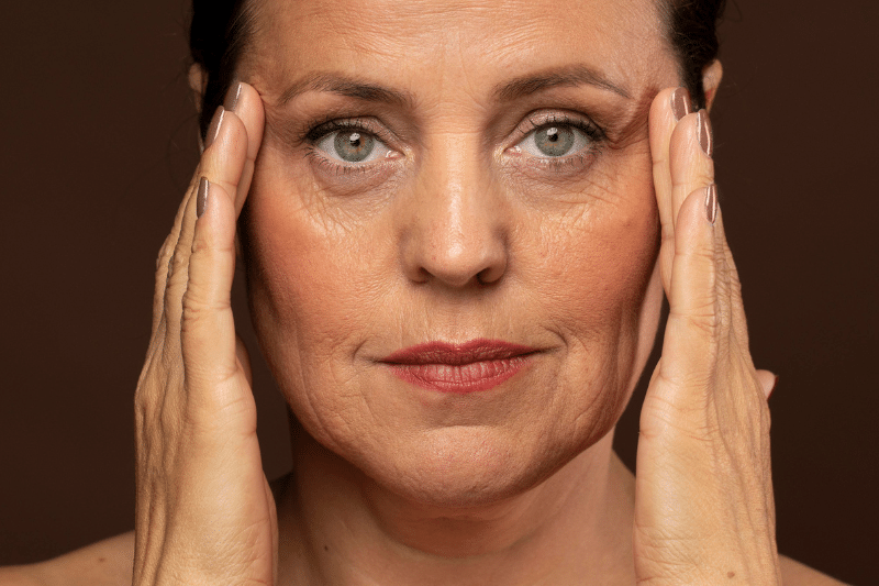 flacidez facial